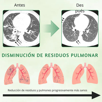 SPRAY NASAL HERBAL – Limpia tus pulmones y alivia tu respiración - 2 Unidades