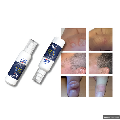 WartRemover™ - Elimina verrugas sin bisturí, sin dolor y desde casa - 2 Unidades