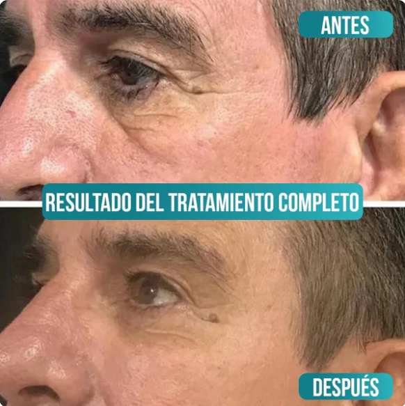Crema antiedad de colageno para-hombres