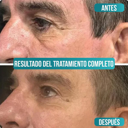 Crema antiedad de colageno para-hombres