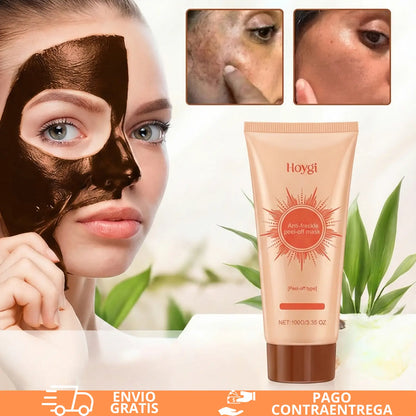 Tu piel no está manchada. Está pidiendo rescate.