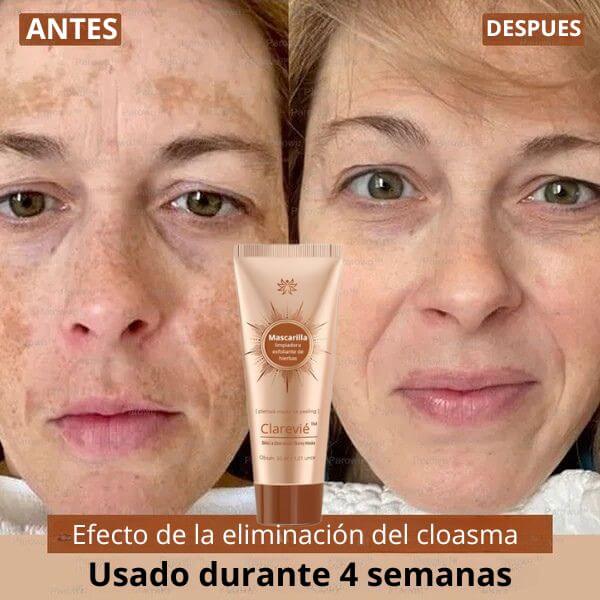 Tu piel no está manchada. Está pidiendo rescate.