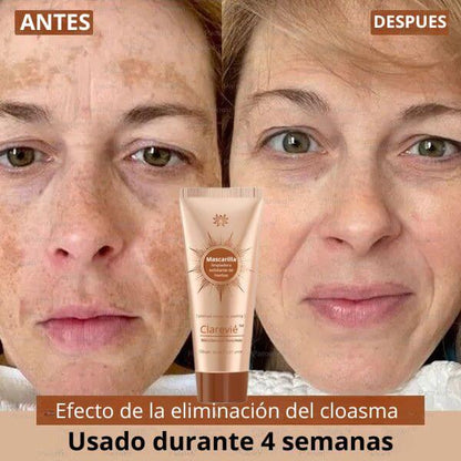 Tu piel no está manchada. Está pidiendo rescate.