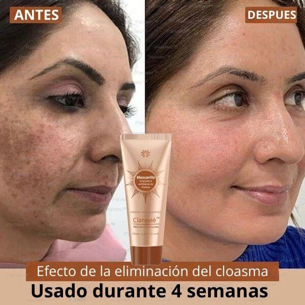 Tu piel no está manchada. Está pidiendo rescate.