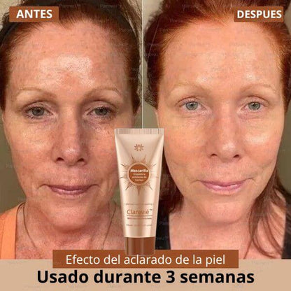 Tu piel no está manchada. Está pidiendo rescate.