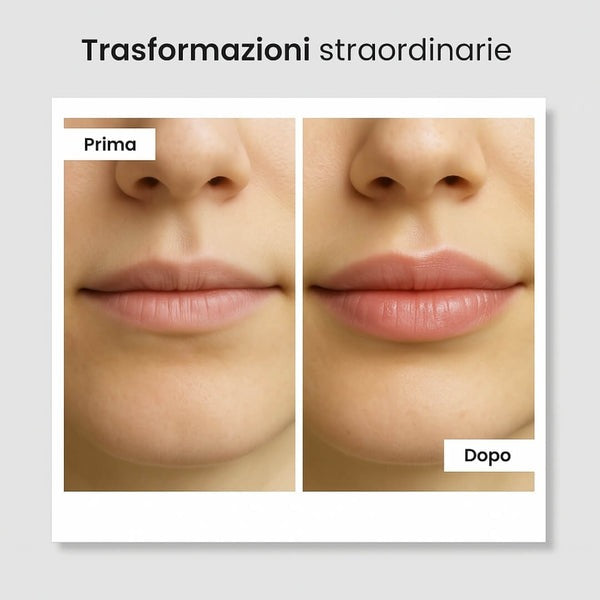 Kit de labios Revie™